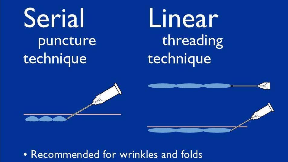 Injection Techniques NB: Preferred technique: Linear