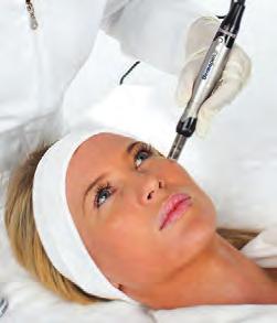 The treatment is a form of collagen induction therapy where a series of needles penetrate the skin causing thousands of micro injuries at a vertical angle using a specialist medical device, for both