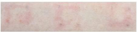 Healthy skin Damaged skin Damaged skin + Modified from Journal of Dermatological Science 75(2014)163-168 Aquatide-TripleShield Silver