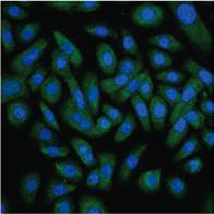 collagen gene expression in fibroblast cells, but also