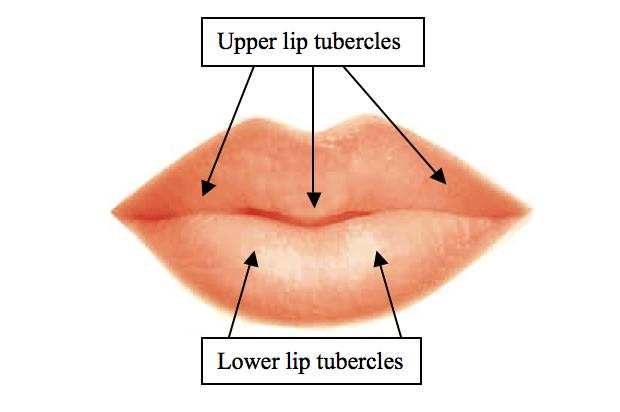 1085 FIGURE 12. The tubercles of the upper and lower lips are natural areas of prominence that should be enhanced during lip augmentation. 5. Take frontal and lateral preoperative photos. 6.