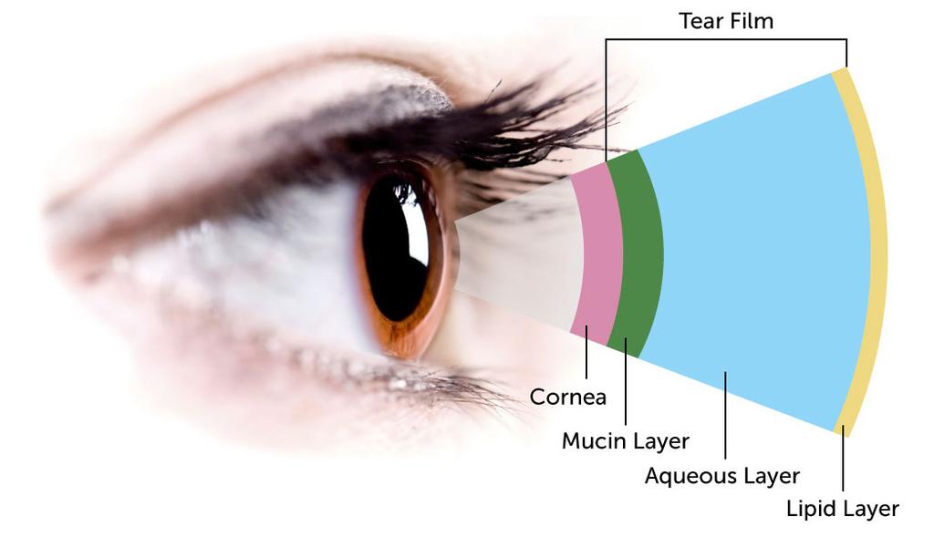What is Dry Eye? Dry eye is a complex, multifactorial disease process that affects the eyes ability to produce healthy lubrication for the ocular surface.