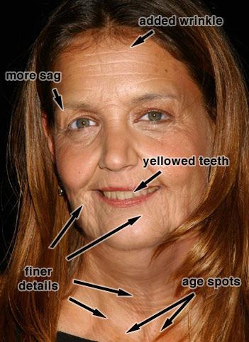 Unless their teeth were subjected to regular whitening, most people s teeth yellow with age. Gums also recede, showing less gum and more bone.