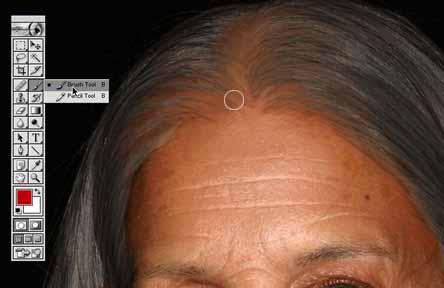 opacity so that they could show through from the original image. Step 14: Hair Raising The next step was to raise the hairline and thin out the hair. Hair loss is common with both sexes.