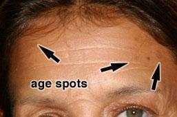 Step 11: Adding Age Spots A key component to effective aging of a face is the addition of age spots.
