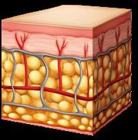 The beams are arranged in two matrices- 7x7 (49 pixels) or 9x9 (81 pixels). The beams cause select ablation in micro-columns in the skin that are separated by healthy tissue.