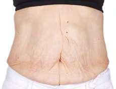 AGELOC GALVANIC BODY SPA RESULTS - CONTOURS, SMOOTHS AND FIRMS YOUR BODY FOR A YOUNGER YOU.