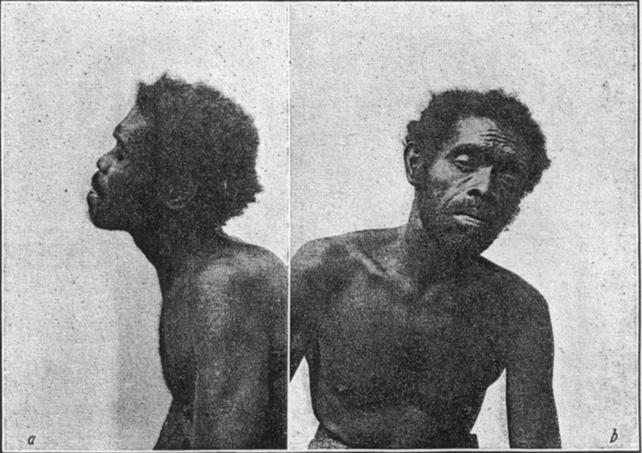 224 A ME RICAN A NTHR 0 POL OG IS T [N. S., 12, 1910 Iberian physiognomy. Such a Negrito is seen in figure 15.