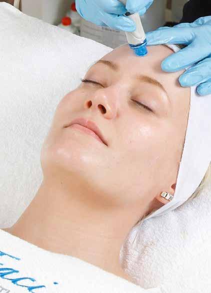 HYDRAFACIAL HOW IT WORKS CLEANSE + PEEL Uncover a new layer of skin with gentle exfoliation and relaxing resurfacing. EXTRACT + HYDRATE Remove debris from pores with painless suction.