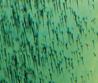 Figure 13. In the Chinese samples, the numerous tiny crystals at the broad ends of the spicules may appear as masses at the surface of the seed (left; immersion, magnified 50 ).