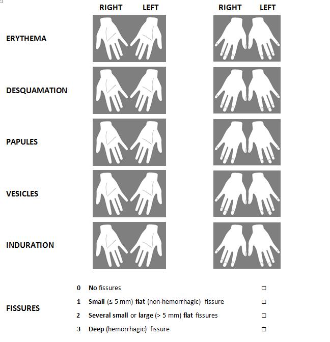 Methods Clinical examination of hands by occupational health