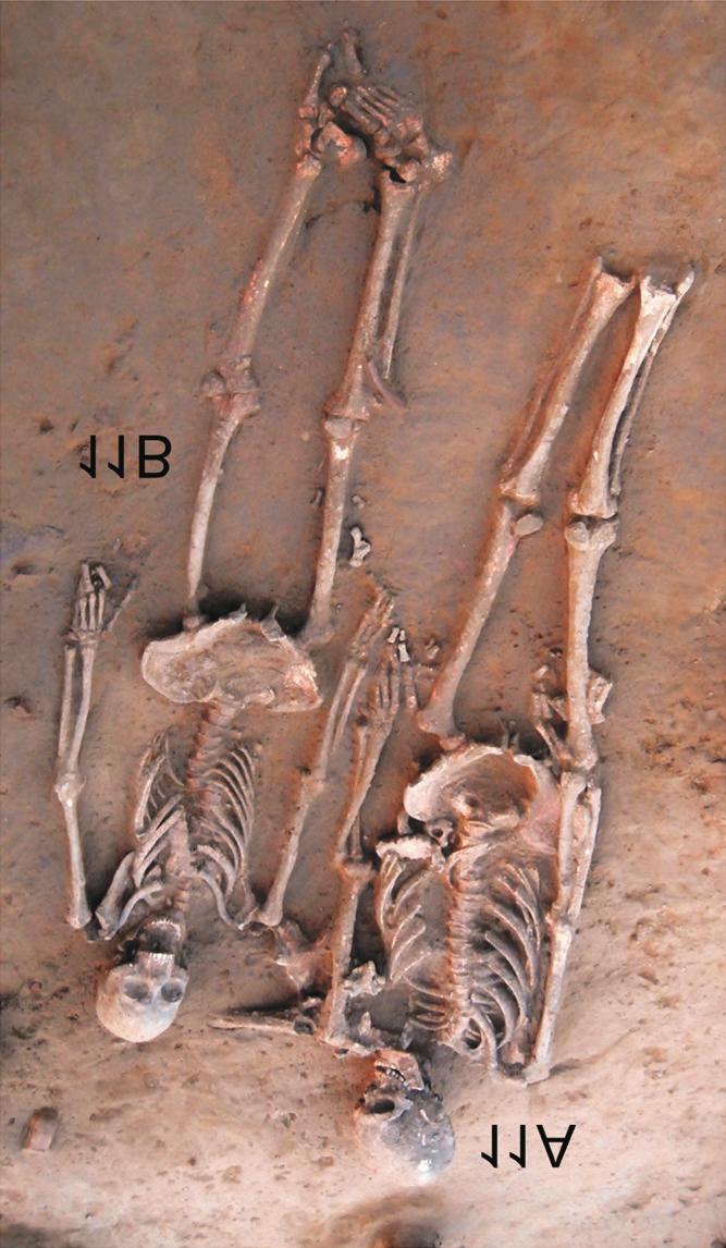202 Anat Cell Biol 2018;51:200-204 Vasant Shinde, et al 0 1 M Fig. 2. The 11A and 11B skeletons. Their heads were placed towards north. The burial for 11A and 11B dug over an earlier grave of 12.