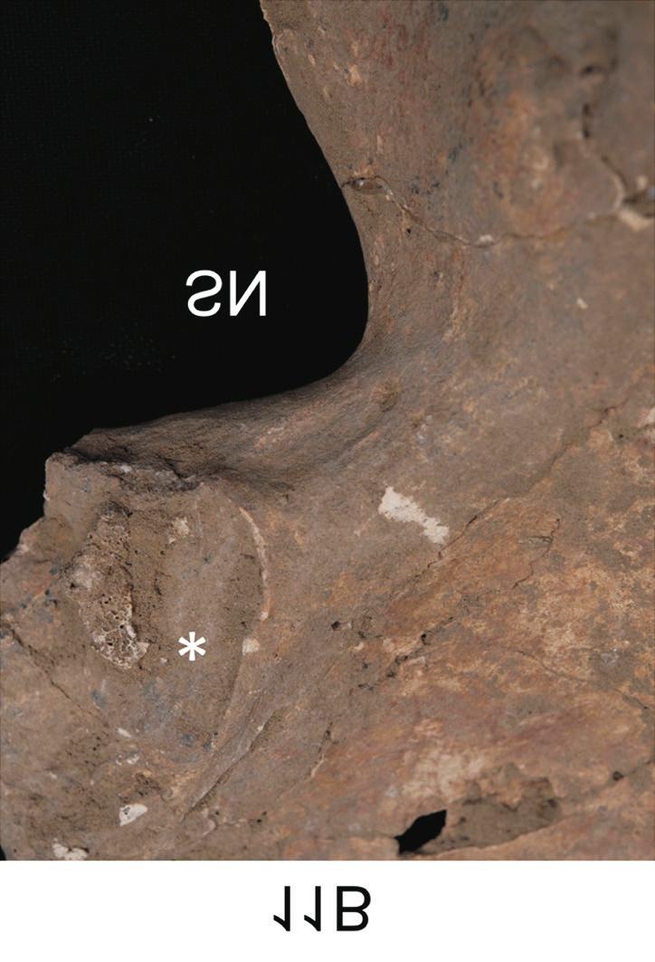 A couple s grave found at the Harappan Civilization cemetery Anat Cell Biol 2018;51:200-204 203 Fig. 4. Sex estimation of 11A and 11B. Asterisks for auricular surface.