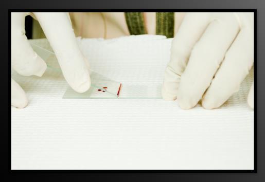 Proceed with making (thin) smear as prepared for blood cell identification and enumeration Wipe finger with cotton Making a Thin Film: Using a second clean slide as