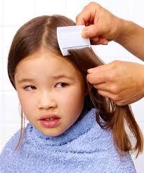 Combing Head lice and their eggs may be removed from the hair by combing the