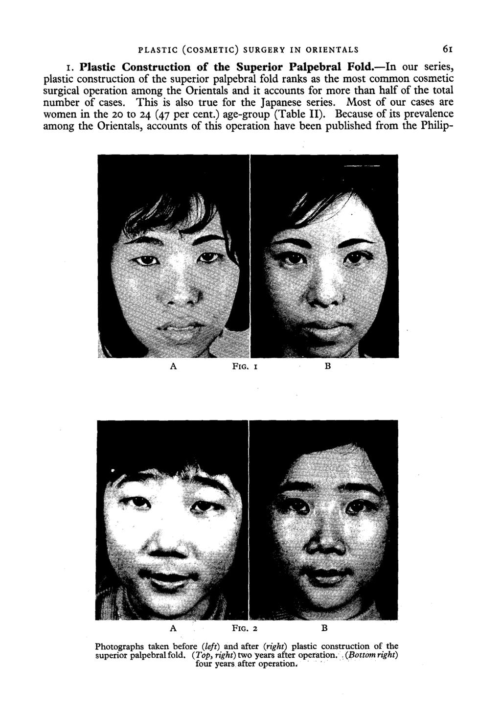 PLASTIC (COSMETIC) SURGERY IN ORIENTALS 61 I. Plastic Construction of the Superior Palpebral Fold.