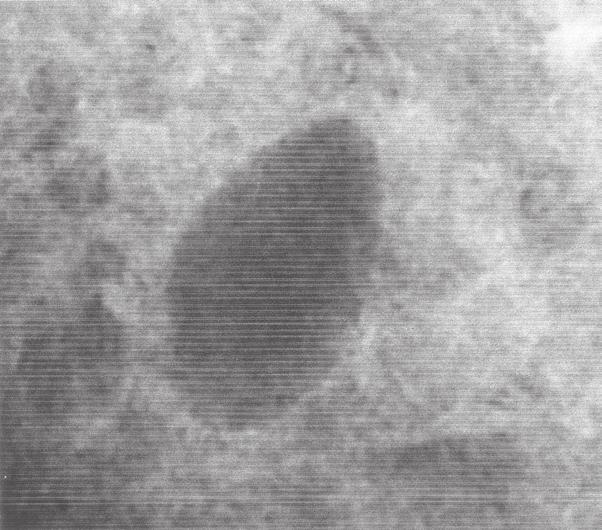 96 Koerper, Labbé and Jull Fig. 9. Close-up of lozenge-shaped treasure object seen in X-ray of Fig. 8. Roech, M.D.