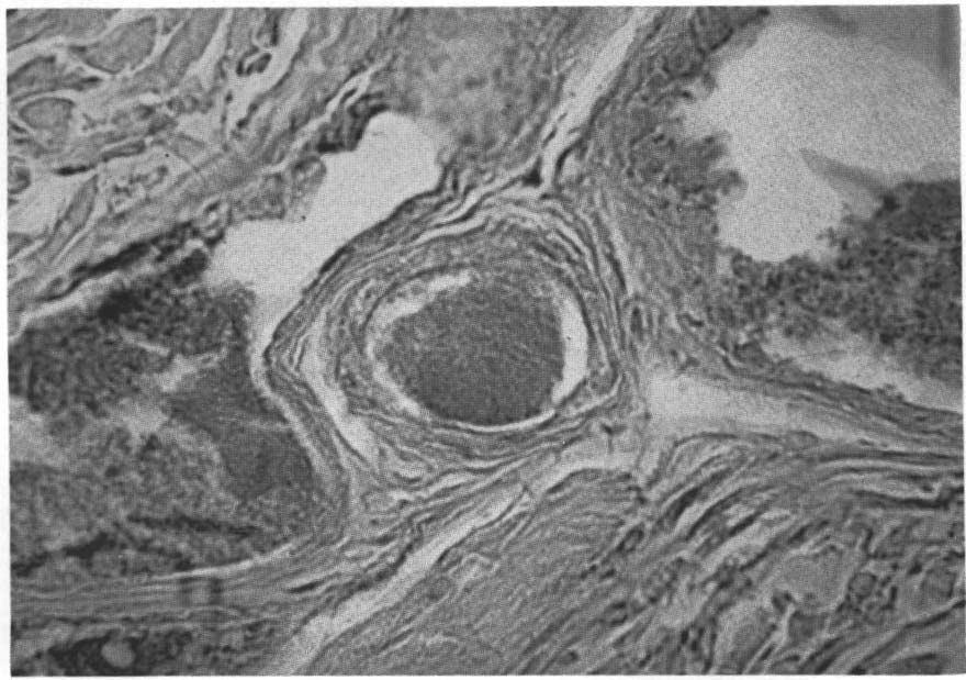 (Fig. 12). The secretory cells the unit. contain occasional small secretion granules as well (3) Apocrine glands.