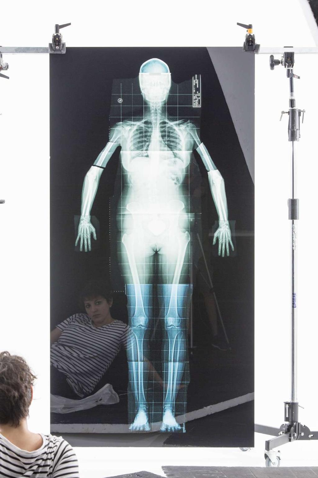 Self-portrait, 2015 Direct print on plexiglass 178 cm x 80 cm x 0,5 cm An x-ray self-portrait is completed with several radiographies of strangers, which converge in shaping a unique whole.
