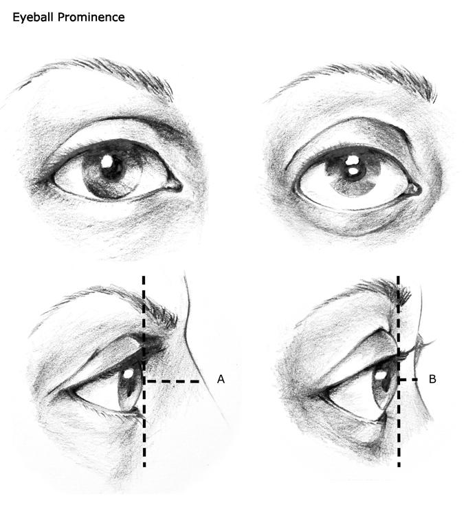 255 FIG 8 Anterior (Forward) Projection of the Eyes 256 257 258 NOTE - A shows an eye with minimal prominence (projection forward from