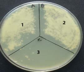 control UV sensitive yeast strain (without DNA repair system) The UV protection of