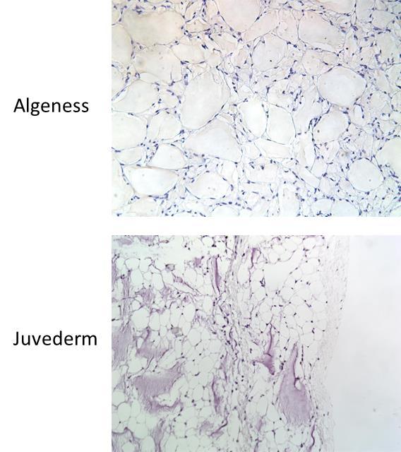 Figure 11. Ly6g staining of frozen sections at 24 weeks post-injection. (200x magnification) Conclusion Algeness maintained a more consistent presence at the injection site.
