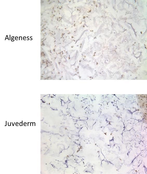 sections of Algeness and Juvederm at 1 week post-injection