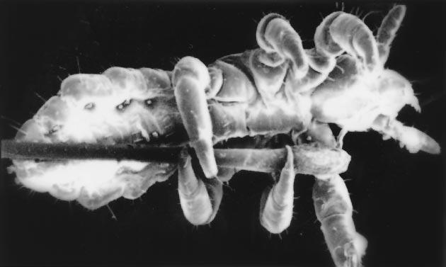 Fig 1. An untreated head louse standing on a hair (from Speare et al, 33 with permission). (Magnification: 37.5.) Fig 2. A Nuvo-treated head louse coated with dried-on DSP lotion. (Magnification: 37.5.) entered trial 1.