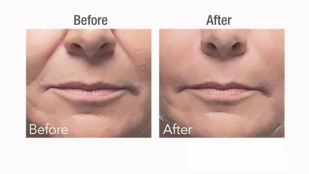 A&P facial s recognized by our insurance. Botox and filler training by our experienced team of medics Filler training by are experienced team of medics.