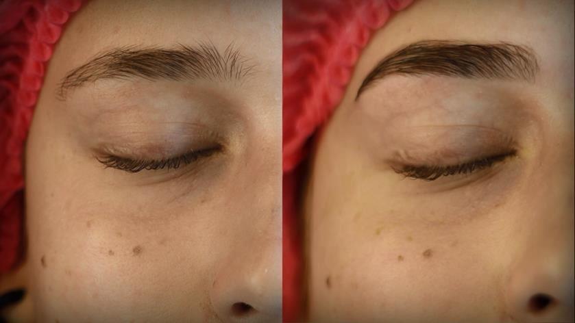 1. Before performing the procedure, remove makeup from eyebrows using oil-free solution. They degrease the eyebrows using a micro-brush and degreasing solution (MAYAMY Aroma Primer). 2.