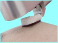 STEP : Wet Exfoliation - use the Sapphire Peel handpiece following the directional arrow chart, turn the dial on