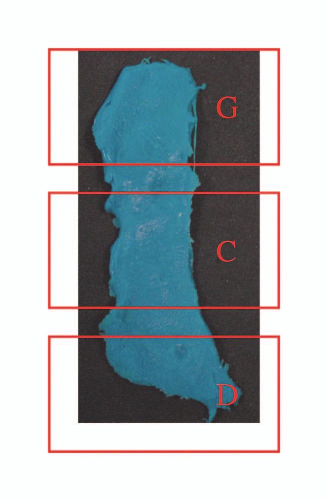 Figure 1. Marked silicone skin surface replica of the perioral region indicating the location of three set sites (G, C, and D) that were used for the measurements. Figure 2.