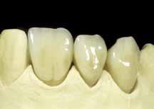 Initial IQ Lustre Pastes NF are compatible to almost all types of dental ceramic GC Initial IQ
