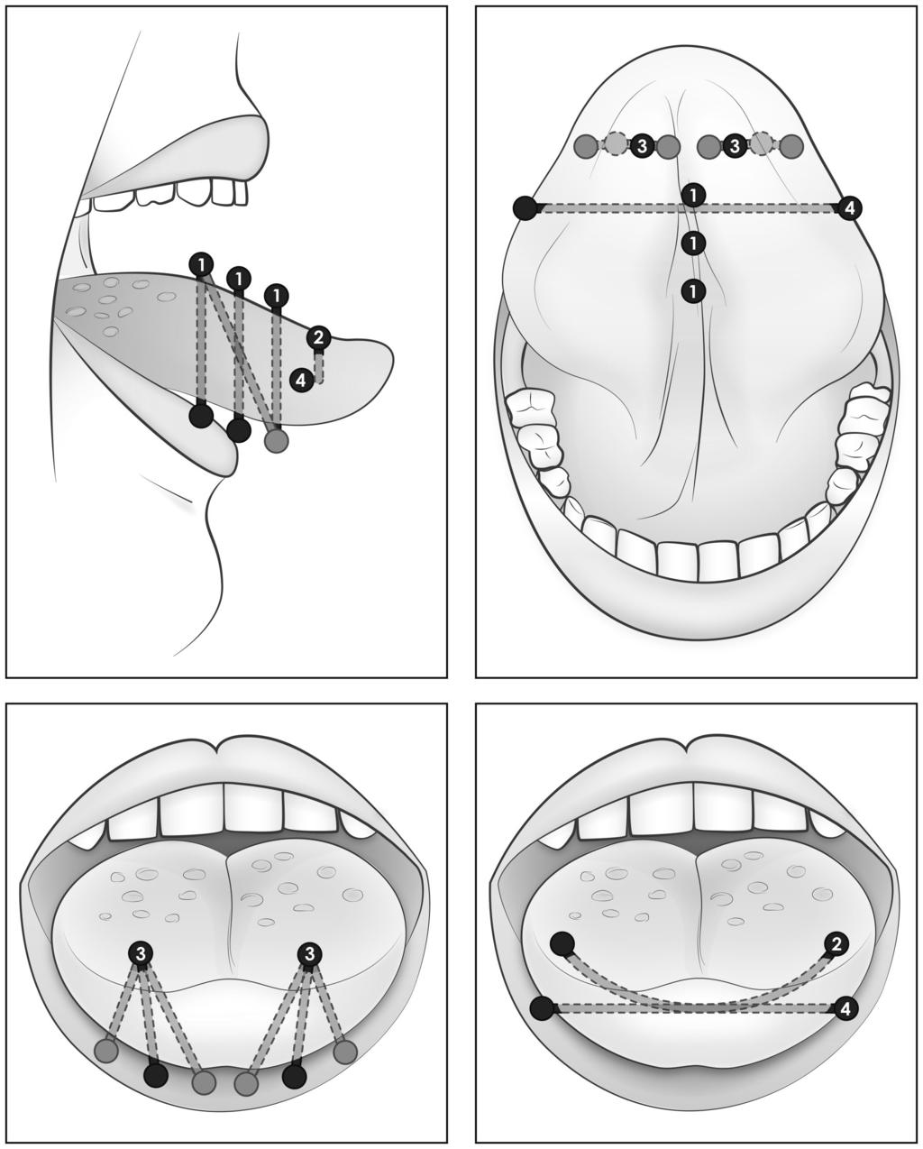 Section 3: Tongue and oral piercings 1.