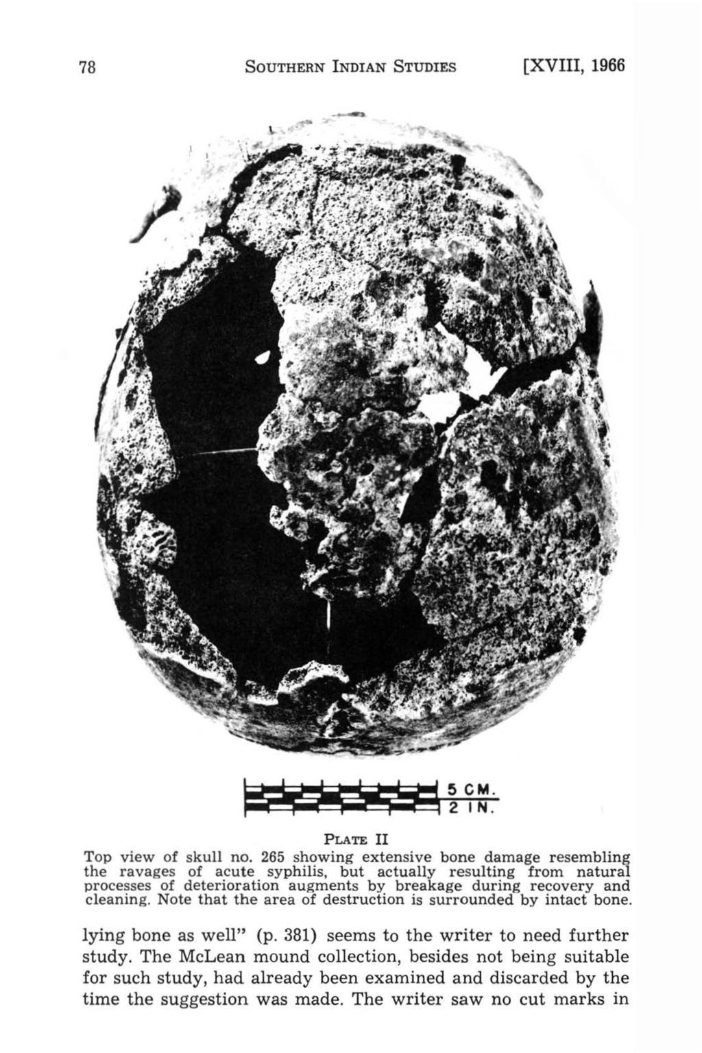 78 SouTHERN NDAN STUDES [XV, 1966 \. ---- PLATE Top view of skull no.