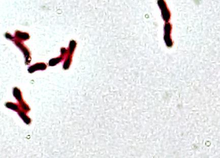 Genus Propionibacterium: phenotypic characteristics