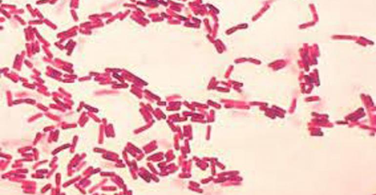 The Gram stain procedure enables bacteria to retain color of the stains, based on the differences in the chemical and physical properties of the cell wall. 1.