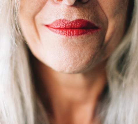 Fine Lines & Wrinkles Photodamage, breakdown of collagen, free radicals, dryness, diet, sleep, and genetics are all factors in how and when age begins to show.