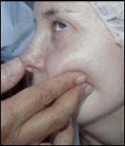 Evaluation of pigmentation