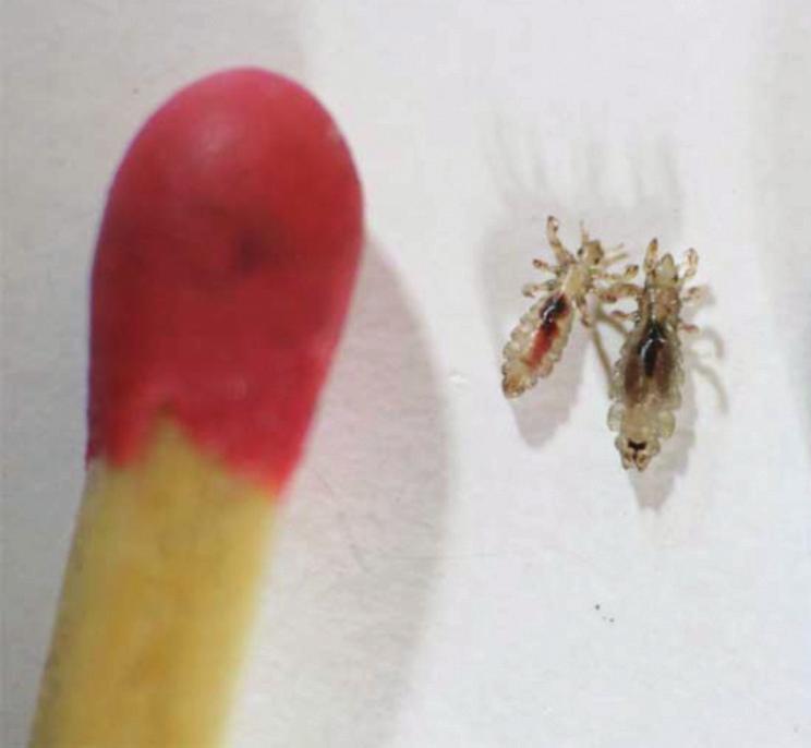 What are head lice? Source: www.en.wikipedia.org What are nits? Head lice are small wingless insects with six legs.