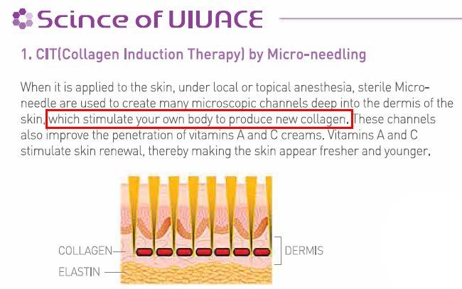 Exhibit 4 Exemplary Infringement Claim Chart for U.S. Patent No. 9,095,357 Vivace Claim 1 Representative Accused Product: Vivace See, e.g., Science of Vivace Webpage, http://vivaceexperience.