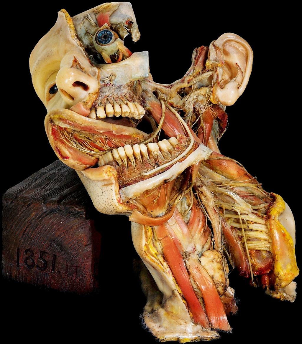 2 Fig. 1: Joseph Towne, Dissection of the head and neck, c. 1851. Gordon Museum, King s College London.
