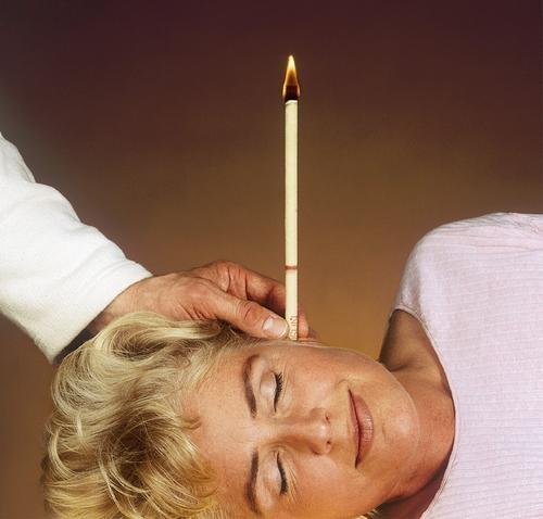 Ancient Indian Ritual Ear candling can benefit the following: Excessive wax build up Sinus