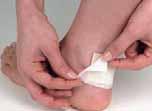 Substitute for the natural plantar pad. Distributes pressure & relieves pain instantly. Prevention Plaster with Epithelium 28 D5050-6.99 Minimal thickness (2mm) of cushion for comfort.