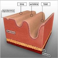 Skin Damage and Wrinkle Formation The skin is composed of two layers know as the epidermis and dermis.