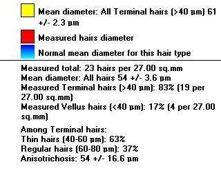 Hair diameter: Measured total: 34 hairs per 27.00 sq.mm Mean diameter: All hairs 54 +/- 3.6 µm Mean diameter: All Terminal hairs (>40 µm) 61 +/- 2.