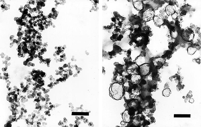 Electron micrograph showing pretreatment electron-dense particles (arrows) in cytoplasm of fibroblast (A), and posttreatment mixture of electron-dense particles and electron-lucent particles with