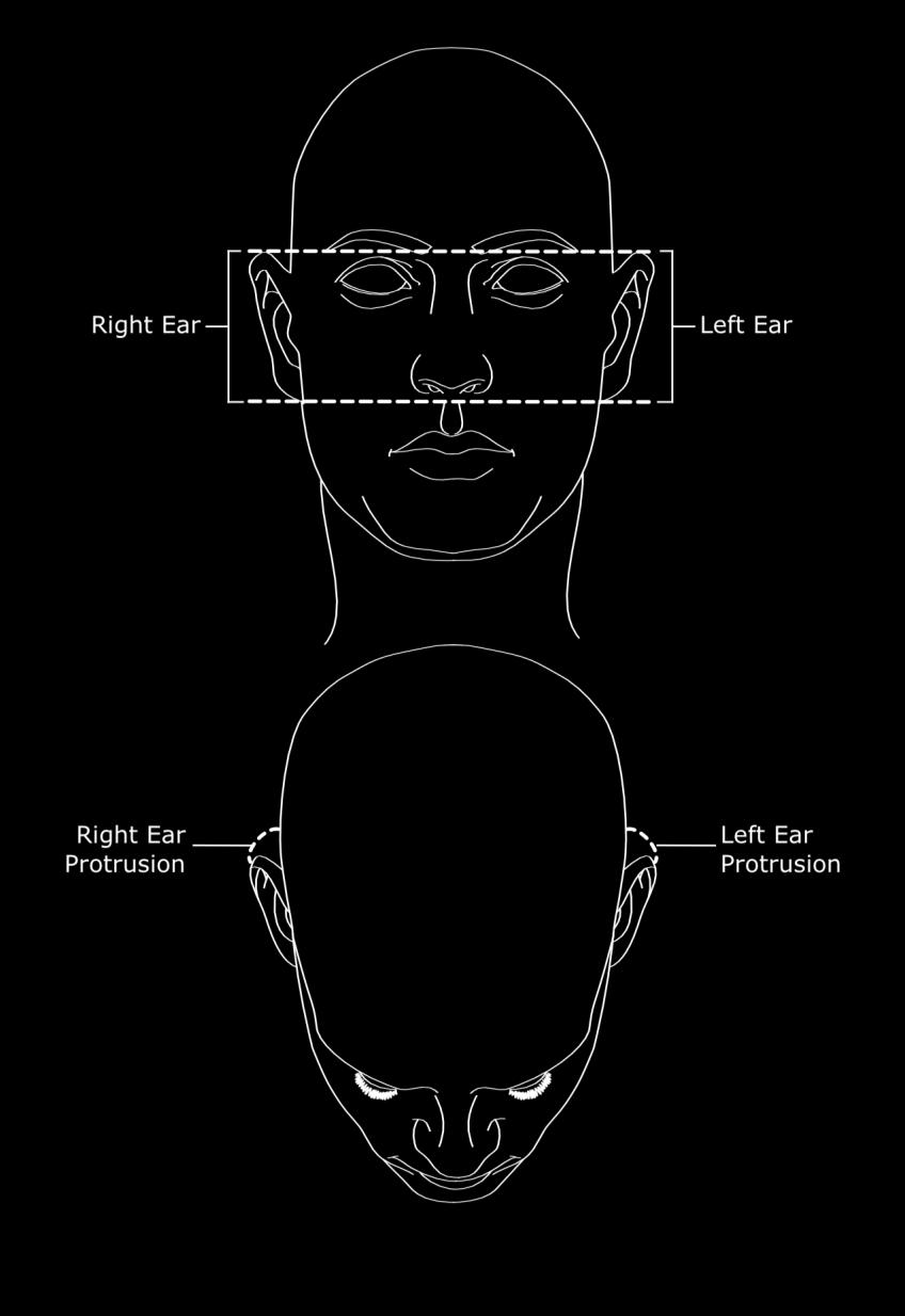 FIG 11 Ear Position Facial Image