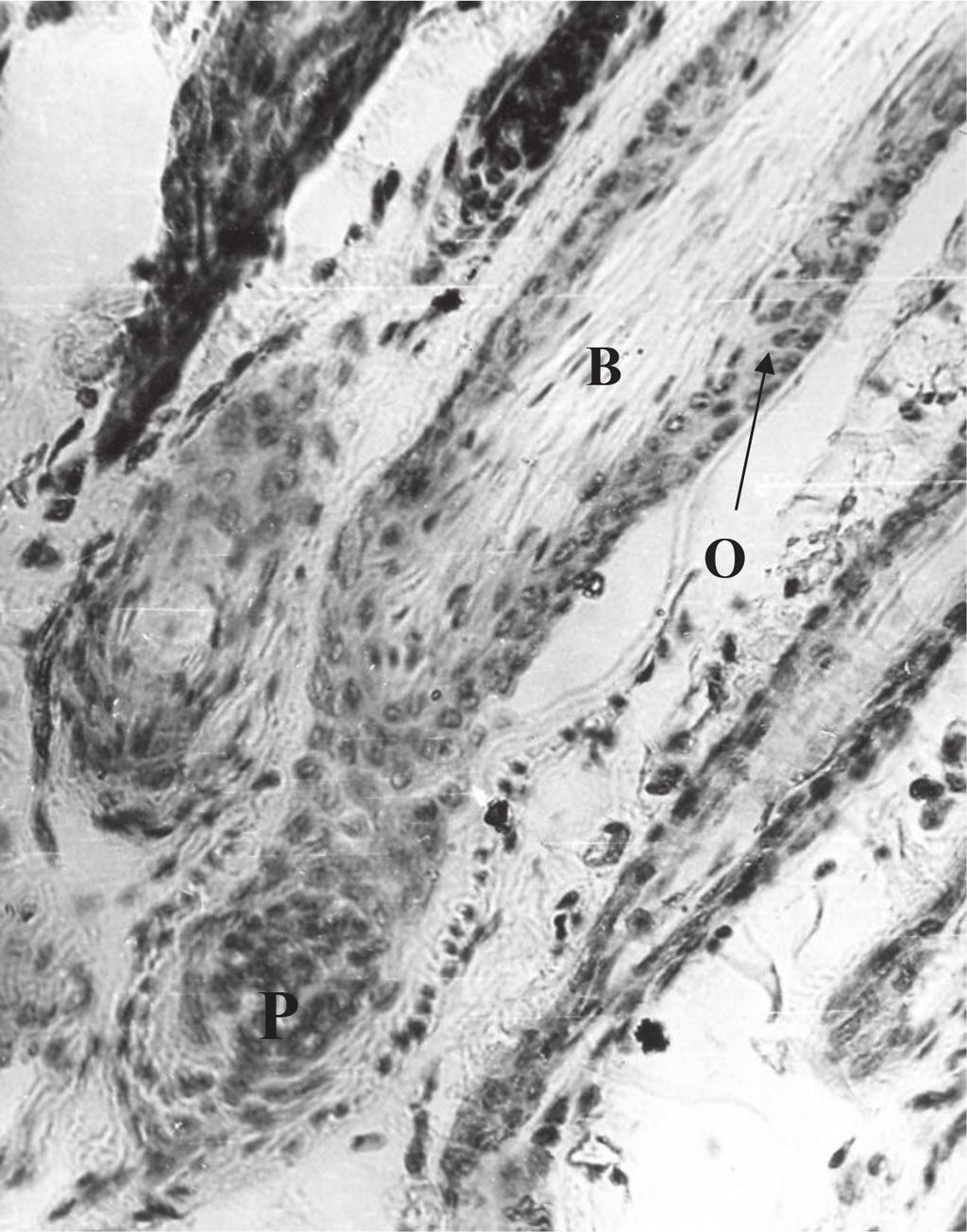 The Histological Mechanisms of Hair Loss http://dx.doi.org/10.5772/67275 75 growth for approximately 2 weeks. The transition from anagen VI to telogen occurs through the phase named the catagen.
