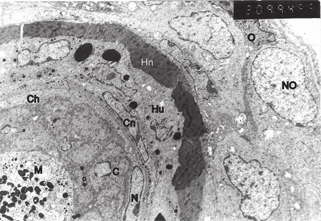 70 Hair and Scalp Disorders Figure 3. The electron microscopic photo of the transversal section of mouse hair follicle on the level of keratogenic zone.